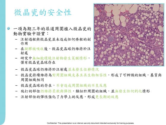 微晶瓷塑形技術安全性與效能