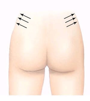 身體埋線:腰腹