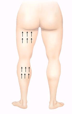 身體埋線:大腿和小腿